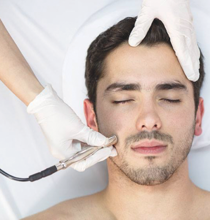 Facial Microdermoabrasión